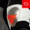 Knee plate replacement (single)